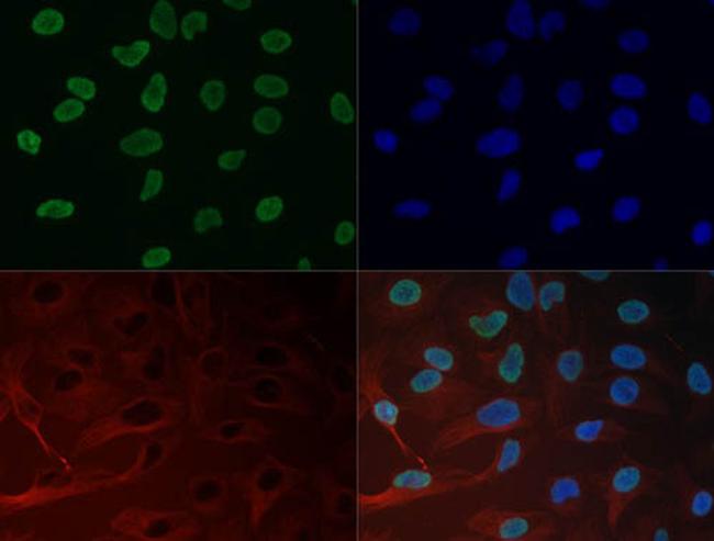 H3K27me3 Antibody in Immunocytochemistry (ICC/IF)