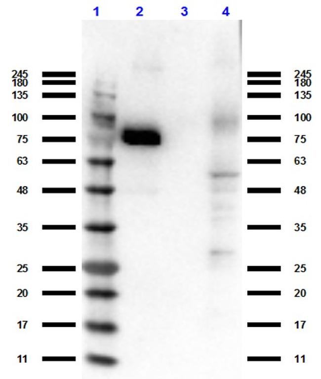 RON Antibody in Western Blot (WB)