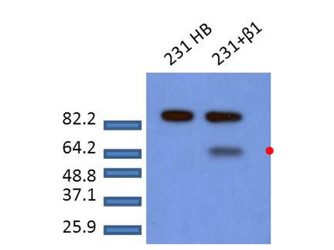 Phospho-SMAD2 (Ser465, Ser467) Antibody in Western Blot (WB)