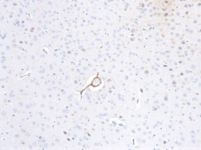 p35 Antibody in Immunohistochemistry (IHC)