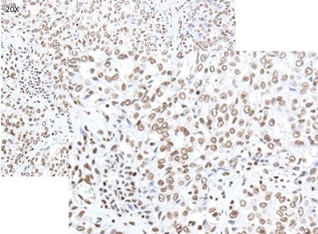 Smoothened Antibody in Immunohistochemistry (IHC)