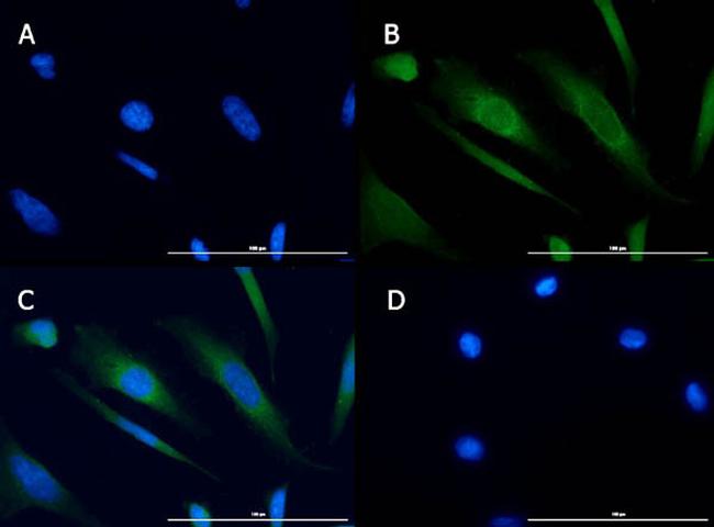 TBK1 Antibody in Immunocytochemistry (ICC/IF)