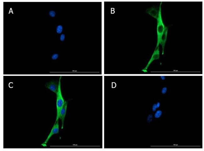 SNAI1 Antibody in Immunocytochemistry (ICC/IF)