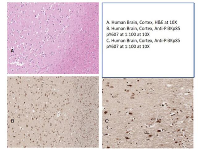 Phospho-PI 3 Kinase p85 alpha (Tyr607) Antibody in Immunohistochemistry (IHC)