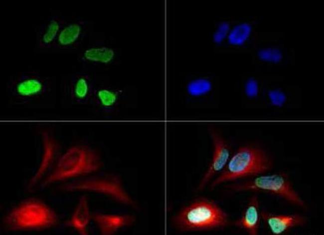 H3K79me1 Antibody in Immunocytochemistry (ICC/IF)