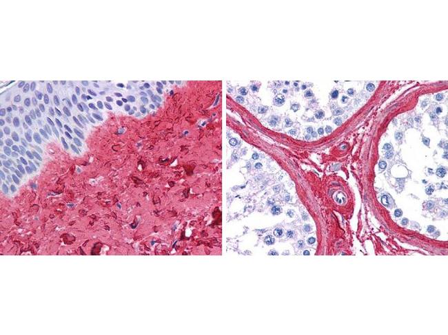 Collagen Type III Antibody in Immunohistochemistry (Paraffin) (IHC (P))