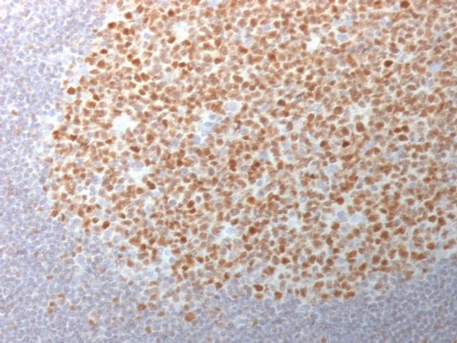 Bcl-6 Antibody in Immunohistochemistry (Paraffin) (IHC (P))