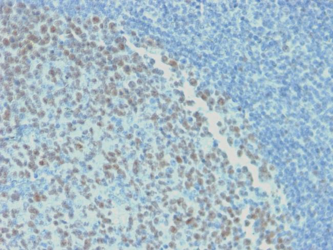 Bcl-6 (Follicular Lymphoma Marker) Antibody in Immunohistochemistry (Paraffin) (IHC (P))