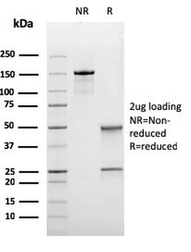 Bcl-6 (Follicular Lymphoma Marker) Antibody in SDS-PAGE (SDS-PAGE)