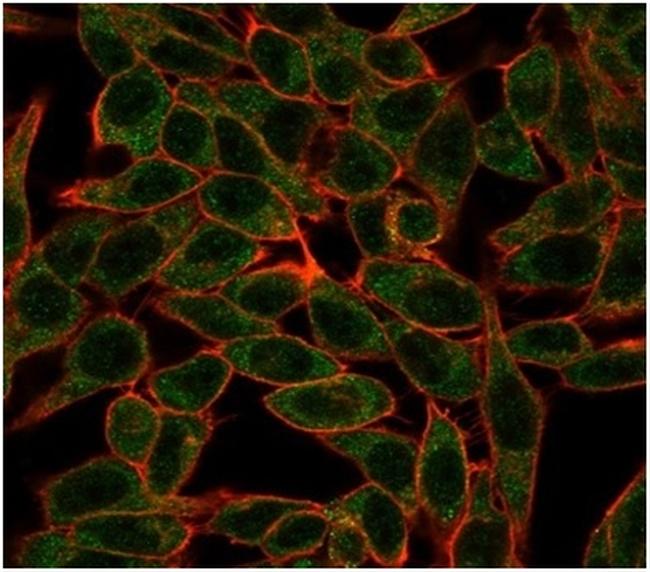 BCL6 Antibody in Immunocytochemistry (ICC/IF)