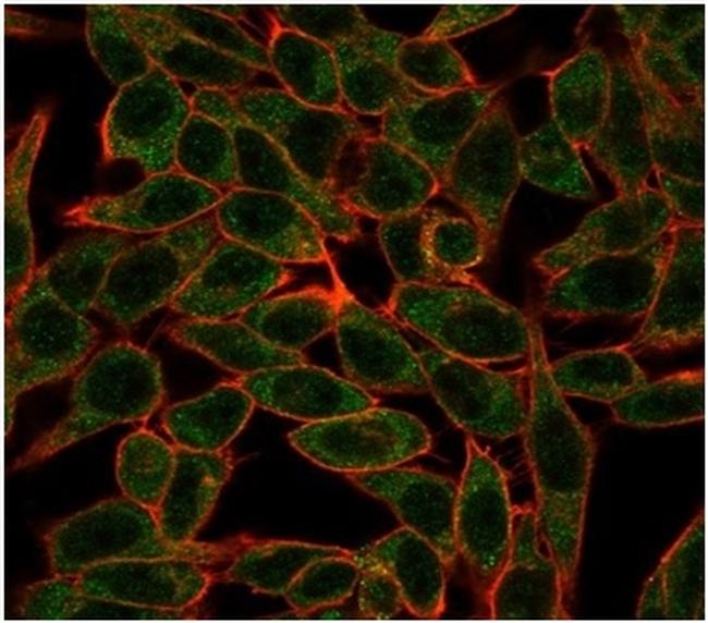 BCL6 Antibody in Immunocytochemistry (ICC/IF)