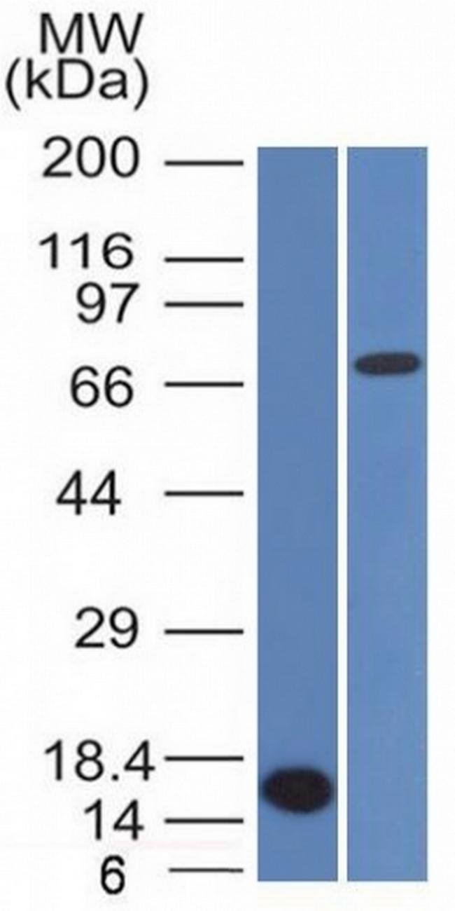 Bcl-6 (Follicular Lymphoma Marker) Antibody in Western Blot (WB)