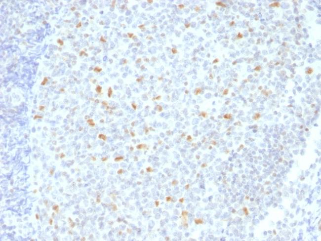 Bcl-6 (Follicular Lymphoma Marker) Antibody in Immunohistochemistry (Paraffin) (IHC (P))