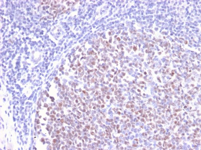 Bcl-6 Antibody in Immunohistochemistry (Paraffin) (IHC (P))