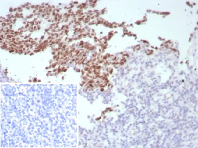 Bcl-6 (Follicular Lymphoma Marker) Antibody in Immunohistochemistry (Paraffin) (IHC (P))