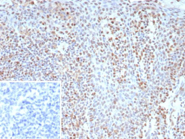 Bcl-6 (Follicular Lymphoma Marker) Antibody in Immunohistochemistry (Paraffin) (IHC (P))