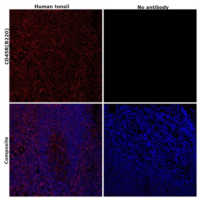 CD45R (B220) Antibody in Immunohistochemistry (Paraffin) (IHC (P))