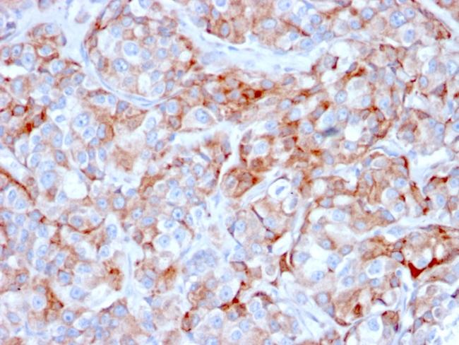 CD269/TNFRSF17/BCMA (B-Cell Maturation Protein) Antibody in Immunohistochemistry (Paraffin) (IHC (P))