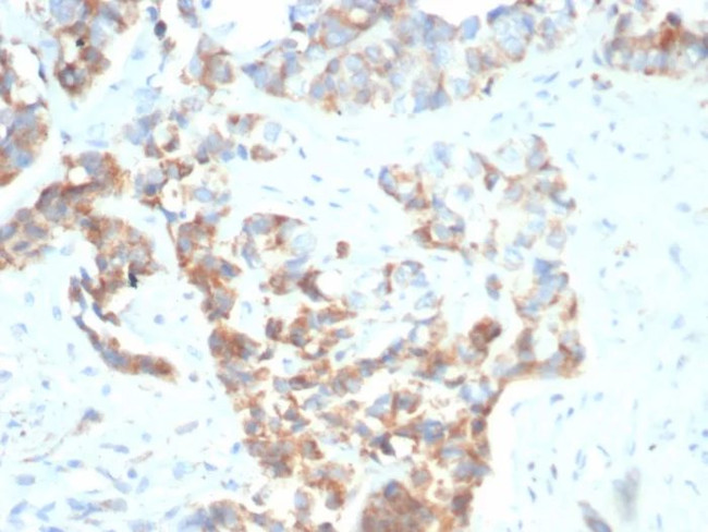 CD269/TNFRSF17/BCMA (B-Cell Maturation Protein) Antibody in Immunohistochemistry (Paraffin) (IHC (P))