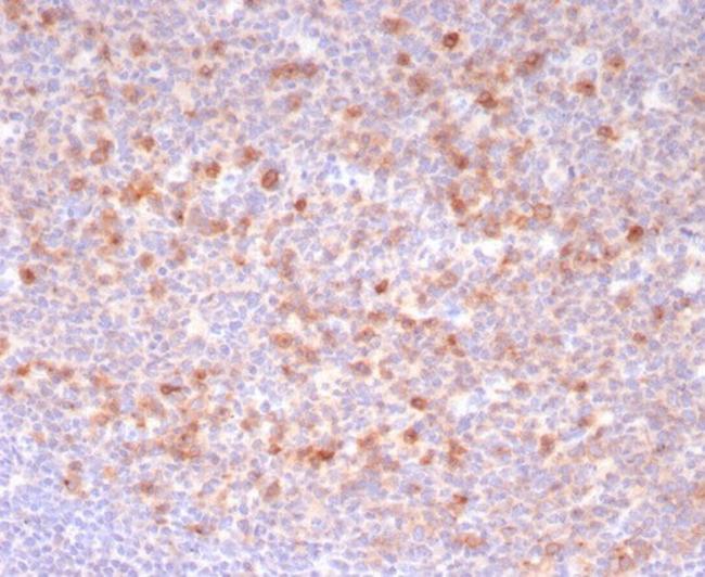 CD269/TNFRSF17/BCMA (B-Cell Maturation Protein) Antibody in Immunohistochemistry (Paraffin) (IHC (P))