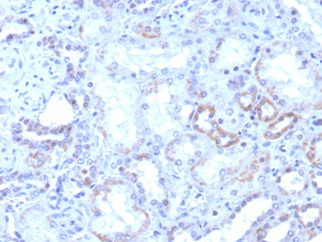 ROR-gamma/RORC (RAR-related Orphan Receptor C) Antibody in Immunohistochemistry (Paraffin) (IHC (P))