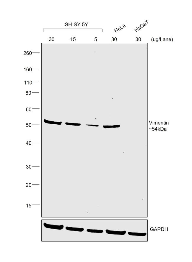 Mouse IgM (Heavy chain) Secondary Antibody in Western Blot (WB)