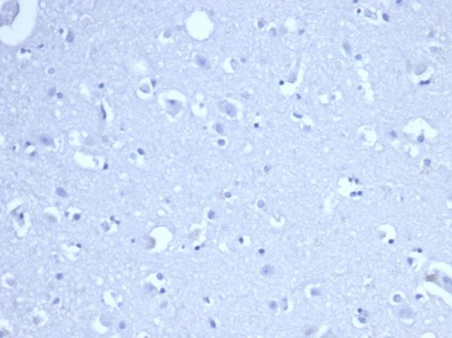 Ribonucleotide Reductase M1/RRM1 Antibody in Immunohistochemistry (Paraffin) (IHC (P))