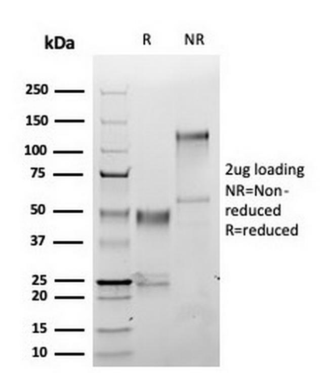 S100A1 (Melanoma Marker) Antibody in SDS-PAGE (SDS-PAGE)