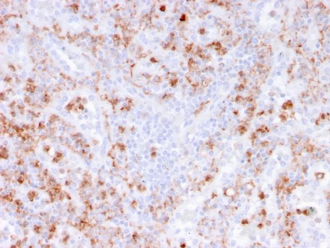 Calprotectin/MRP14/S100A9/Calgranulin B Antibody in Immunohistochemistry (Paraffin) (IHC (P))