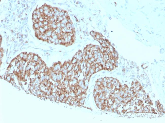 Calprotectin/MRP14/S100A9/Calgranulin B Antibody in Immunohistochemistry (Paraffin) (IHC (P))