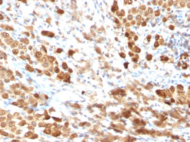 S100B (Astrocyte and Melanoma Marker) Antibody in Immunohistochemistry (Paraffin) (IHC (P))