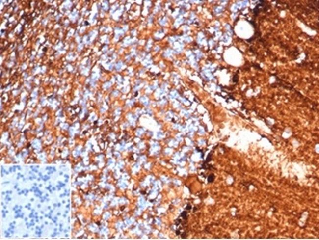 S100B (Astrocyte and Melanoma Marker) Antibody in Immunohistochemistry (Paraffin) (IHC (P))