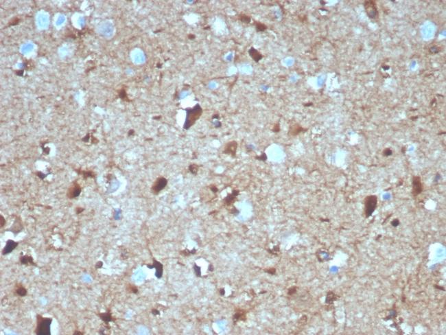 S100B (Astrocyte and Melanoma Marker) Antibody in Immunohistochemistry (Paraffin) (IHC (P))