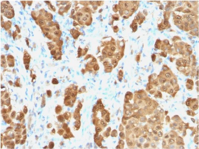 S100B Antibody in Immunohistochemistry (Paraffin) (IHC (P))