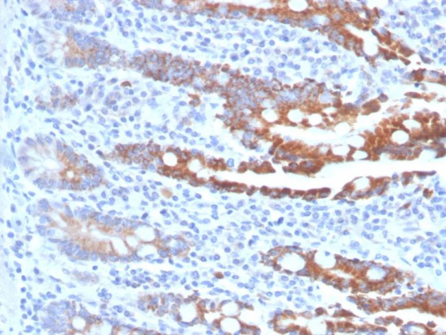 CEACAM1 (CEA Cell Adhesion Molecule 1) Antibody in Immunohistochemistry (Paraffin) (IHC (P))