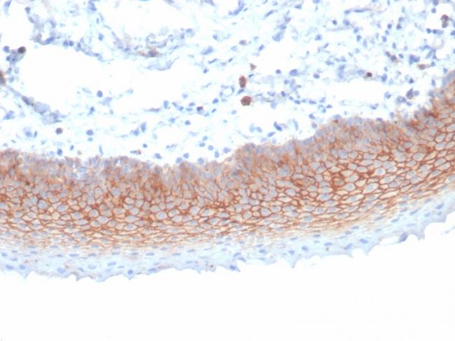 CD138/Syndecan-1 (SDC1) (Plasma Cell Marker) Antibody in Immunohistochemistry (Paraffin) (IHC (P))