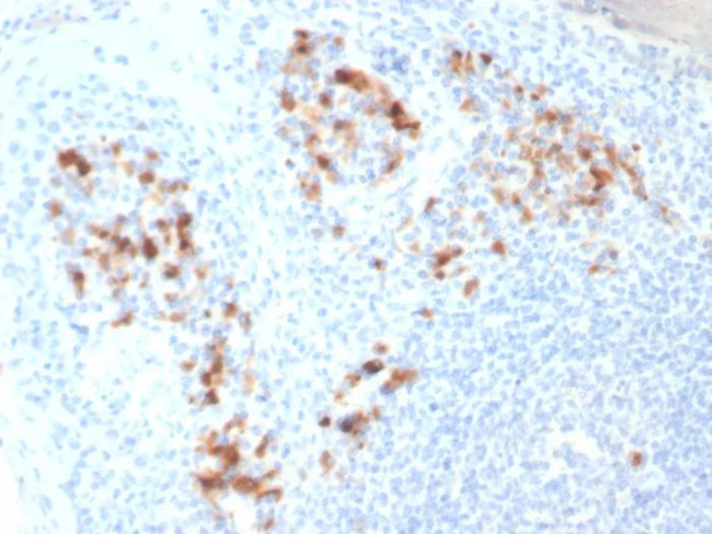 CD138/Syndecan-1 (SDC1) (Plasma Cell Marker) Antibody in Immunohistochemistry (Paraffin) (IHC (P))