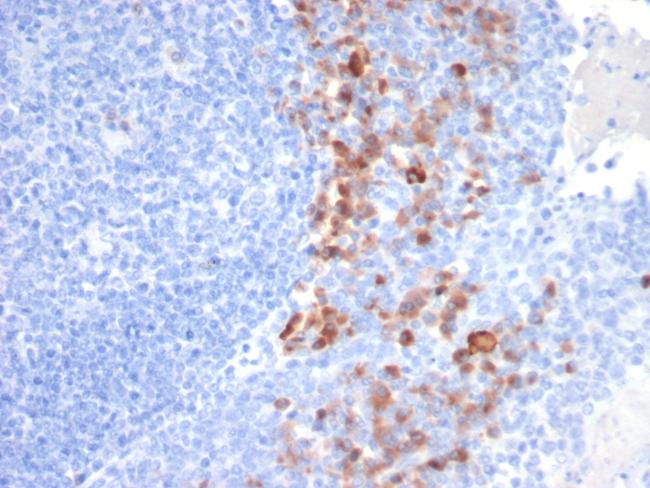 CD138/Syndecan-1 (SDC1) (Plasma Cell Marker) Antibody in Immunohistochemistry (Paraffin) (IHC (P))