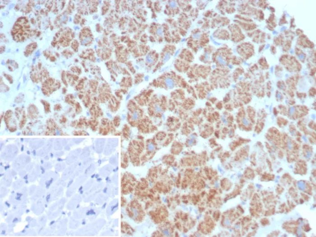 SDHA (Succinate Dehydrogenase Complex Flavoprotein Subunit A) Antibody in Immunohistochemistry (Paraffin) (IHC (P))