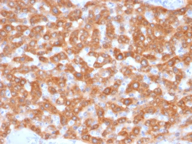 SDHB (Succinate Dehydrogenase B) (Pheochromocytoma Marker) Antibody in Immunohistochemistry (Paraffin) (IHC (P))