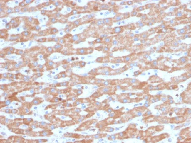 SDHB (Succinate Dehydrogenase B) (Pheochromocytoma Marker) Antibody in Immunohistochemistry (Paraffin) (IHC (P))