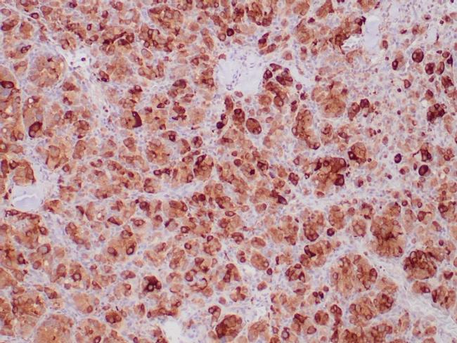 SDHB (Succinate Dehydrogenase B) Antibody in Immunohistochemistry (Paraffin) (IHC (P))