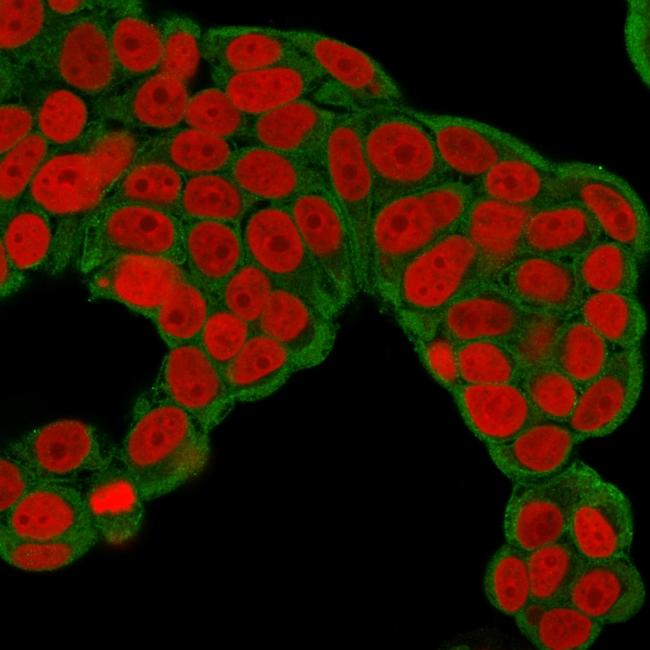 Calcineurin B homologous protein 2/HCC Antigen 520 Antibody in Immunocytochemistry (ICC/IF)