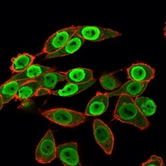 SET Antibody in Immunocytochemistry (ICC/IF)