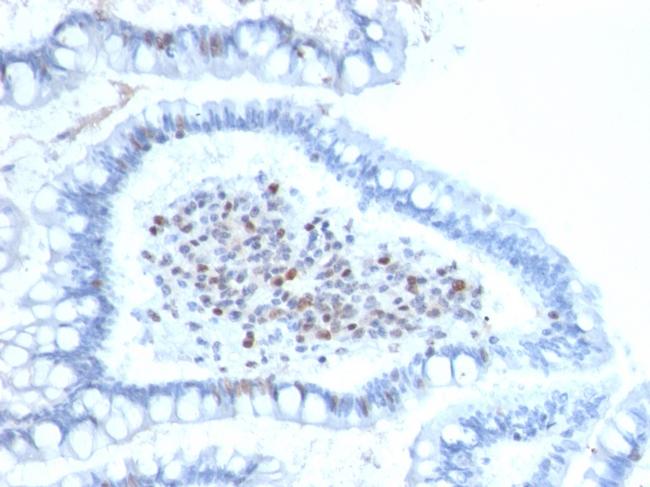 BMI1 Antibody in Immunohistochemistry (Paraffin) (IHC (P))