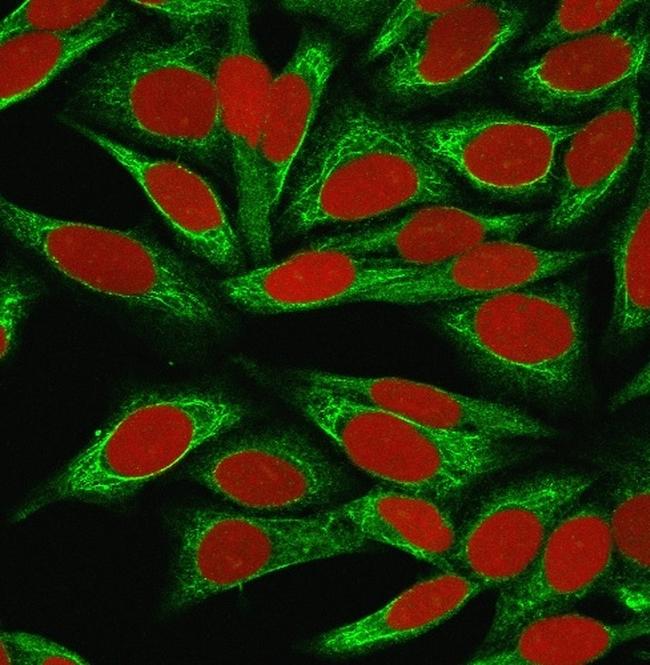 CDw75 (B-Cell Marker) Antibody in Immunocytochemistry (ICC/IF)