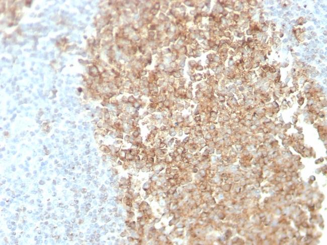 CDw75 (B-Cell Marker) Antibody in Immunohistochemistry (Paraffin) (IHC (P))