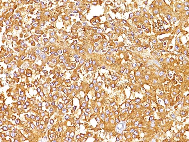 gp100/Melanosome/PMEL17/SILV (Melanoma Marker) Antibody in Immunohistochemistry (Paraffin) (IHC (P))