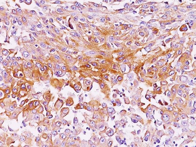 Melanosome gp100/PMEL17/SILV (Melanoma Marker) Antibody in Immunohistochemistry (Paraffin) (IHC (P))