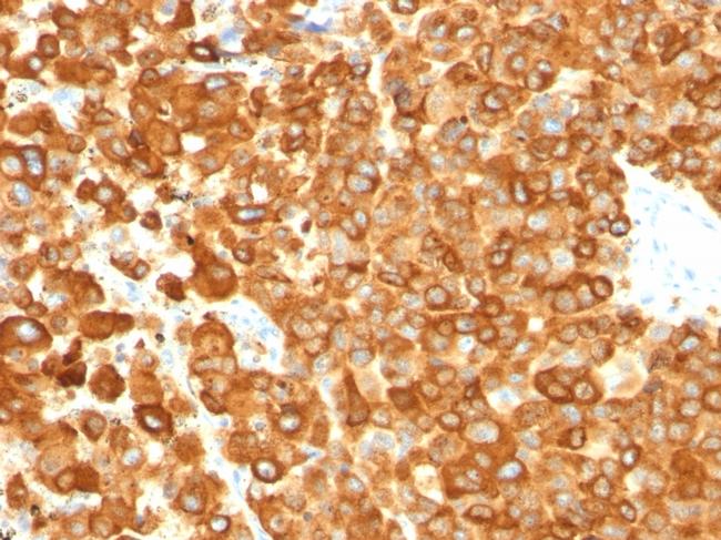 gp100/Melanosome/PMEL17/SILV Antibody in Immunohistochemistry (Paraffin) (IHC (P))